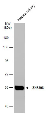 Mouse tissue extract (50 μg) was separated by 7.5% SDS-PAGE, and the membrane was blotted with ZNF398 antibody [C1C3] (GTX107221) diluted at 1:1000. The HRP-conjugated anti-rabbit IgG antibody (GTX213110-01) was used to detect the primary antibody.