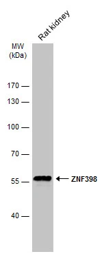 Rat tissue extract (50 μg) was separated by 7.5% SDS-PAGE, and the membrane was blotted with ZNF398 antibody [C1C3] (GTX107221) diluted at 1:1000. The HRP-conjugated anti-rabbit IgG antibody (GTX213110-01) was used to detect the primary antibody.