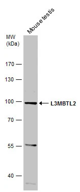Mouse tissue extract (50 μg) was separated by 7.5% SDS-PAGE, and the membrane was blotted with L3MBTL2 antibody (GTX107234) diluted at 1:500.