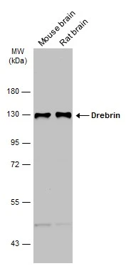 Various tissue extracts (50 μg) were separated by 7.5% SDS-PAGE, and the membrane was blotted with Drebrin antibody (GTX107270) diluted at 1:5000. The HRP-conjugated anti-rabbit IgG antibody (GTX213110-01) was used to detect the primary antibody.