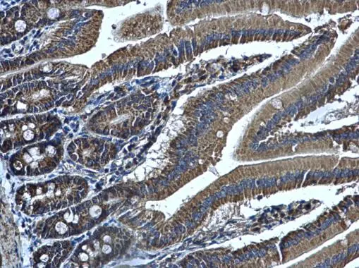 ALDH1B1 antibody detects ALDH1B1 protein at cytoplasm in mouse duodenum by immunohistochemical analysis. Sample: Paraffin-embedded mouse duodenum. ALDH1B1 antibody (GTX107279) diluted at 1:500.
Antigen Retrieval: Citrate buffer, pH 6.0, 15 min ALDH1B1 antibody detects ALDH1B1 protein at cytoplasm in mouse duodenum by immunohistochemical analysis. Sample: Paraffin-embedded mouse duodenum. ALDH1B1 antibody (GTX107279) diluted at 1:500.
Antigen Retrieval: Citrate buffer, pH 6.0, 15 min