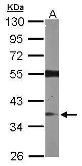 Sample (50 ug of whole cell lysate) A: Mouse brain 10% SDS PAGE GTX107315 diluted at 1:1000
