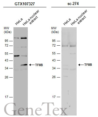 HeLa whole cell and nuclear extracts (30 μg) were separated by 12% SDS-PAGE, and the membranes were blotted with TFIIB antibody [N1C3] (GTX107327) diluted at 1:1500 and competitor's antibody (sc-274) diluted at 1:100. The HRP-conjugated anti-rabbit IgG antibody (GTX213110-01) was used to detect the primary antibody.