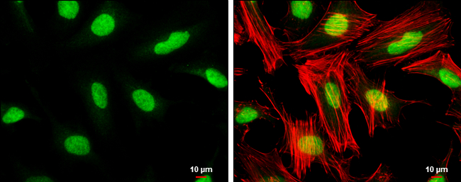 TFIIB antibody [N1C3] detects TFIIB protein at nucleus by immunofluorescent analysis. Sample: HeLa cells were fixed in 4% paraformaldehyde at RT for 15 min. Green: TFIIB stained by TFIIB antibody [N1C3] (GTX107327) diluted at 1:1000. Red: phalloidin, a cytoskeleton marker, diluted at 1:100. Scale bar= 10μm.