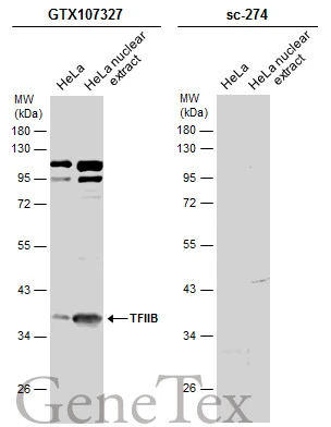 HeLa whole cell and nuclear extracts (30 μg) were separated by 10% SDS-PAGE, and the membranes were blotted with TFIIB antibody [N1C3] (GTX107327) diluted at 1:500 and competitor's antibody (sc-274) diluted at 1:500. The HRP-conjugated anti-rabbit IgG antibody (GTX213110-01) was used to detect the primary antibody. *The competitor is not affiliated with GeneTex and does not endorse this product.