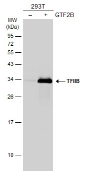Non-transfected (–) and transfected (+) 293T whole cell extracts (30 μg) were separated by 12% SDS-PAGE, and the membrane was blotted with TFIIB antibody [N1C3] (GTX107327) diluted at 1:2000. The HRP-conjugated anti-rabbit IgG antibody (GTX213110-01) was used to detect the primary antibody.
