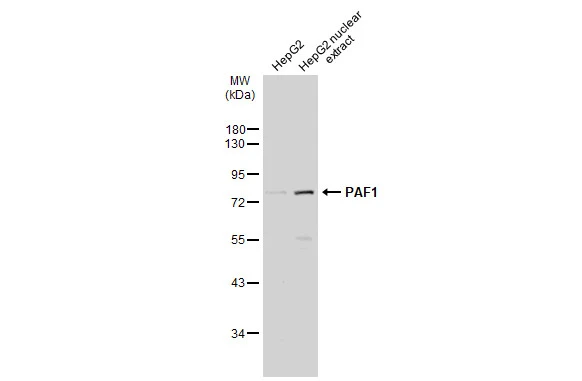 HepG2 whole cell and nuclear extracts (30 μg) were separated by 10% SDS-PAGE, and the membrane was blotted with PAF1 antibody (GTX107346) diluted at 1:5000. The HRP-conjugated anti-rabbit IgG antibody (GTX213110-01) was used to detect the primary antibody