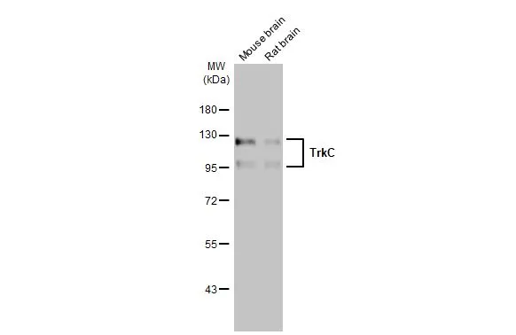 Various tissue extracts (50 μg) were separated by 7.5% SDS-PAGE, and the membrane was blotted with TrkC antibody (GTX107385) diluted at 1:1000. The HRP-conjugated anti-rabbit IgG antibody (GTX213110-01) was used to detect the primary antibody.