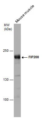 Mouse tissue extract (50 μg) was separated by 5% SDS-PAGE, and the membrane was blotted with FIP200 antibody [N1N2], N-term (GTX107387) diluted at 1:500.