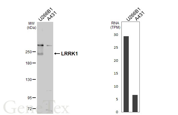 Various whole cell extracts (30 μg) were separated by 5% SDS-PAGE, and the membrane was blotted with LRRK1 antibody [C1C2], Internal (GTX107407) diluted at 1:1000. The HRP-conjugated anti-rabbit IgG antibody (GTX213110-01) was used to detect the primary antibody. Corresponding RNA expression data are based on Human Protein Atlas program.