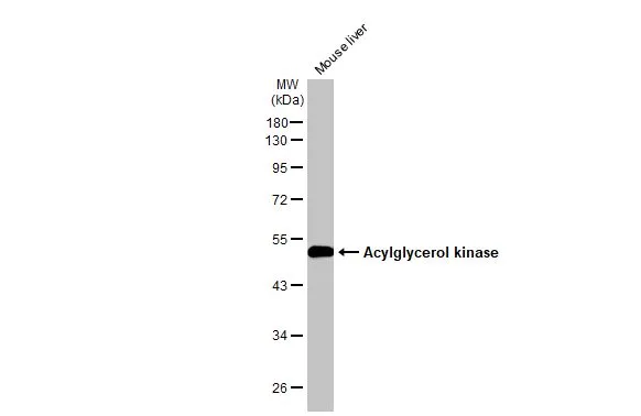 Mouse tissue extract (30 μg) was separated by 10% SDS-PAGE, and the membrane was blotted with Acylglycerol kinase antibody (GTX107413) diluted at 1:1000. The HRP-conjugated anti-rabbit IgG antibody (GTX213110-01) was used to detect the primary antibody.