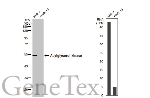 Various whole cell extracts (30 μg) were separated by 10% SDS-PAGE, and the membrane was blotted with Acylglycerol kinase antibody (GTX107413) diluted at 1:500. The HRP-conjugated anti-rabbit IgG antibody (GTX213110-01) was used to detect the primary antibody.
