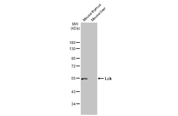 Various tissue extracts (30 μg) were separated by 10% SDS-PAGE, and the membrane was blotted with Lck antibody [N3C3] (GTX107432) diluted at 1:1000. The HRP-conjugated anti-rabbit IgG antibody (GTX213110-01) was used to detect the primary antibody.