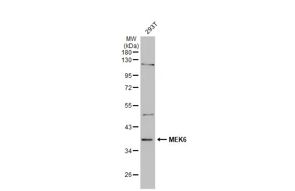 Whole cell extract (30 μg) was separated by 10% SDS-PAGE, and the membrane was blotted with MEK6 antibody [N1C3] (GTX107445) diluted at 1:1000. The HRP-conjugated anti-rabbit IgG antibody (GTX213110-01) was used to detect the primary antibody.