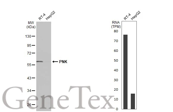 Various whole cell extracts (30 μg) were separated by 10% SDS-PAGE, and the membrane was blotted with PNK antibody [N1C1] (GTX107488) diluted at 1:1000. The HRP-conjugated anti-rabbit IgG antibody (GTX213110-01) was used to detect the primary antibody. Corresponding RNA expression data for the same cell lines are based on Human Protein Atlas program.
