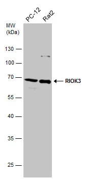 Various whole cell extracts (30 μg) were separated by 10% SDS-PAGE, and the membrane was blotted with RIOK3 antibody (GTX107514) diluted at 1:1000.