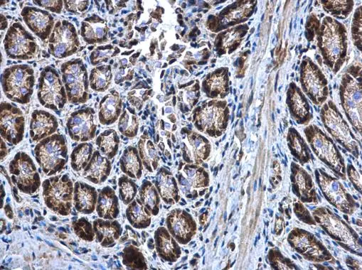 MEK3 antibody [N1C3] detects MEK3 protein at cytoplasm in mouse colon by immunohistochemical analysis. Sample: Paraffin-embedded mouse colon. MEK3 antibody [N1C3] (GTX107529) diluted at 1:500. 
 Antigen Retrieval: Citrate buffer, pH 6.0, 15 min