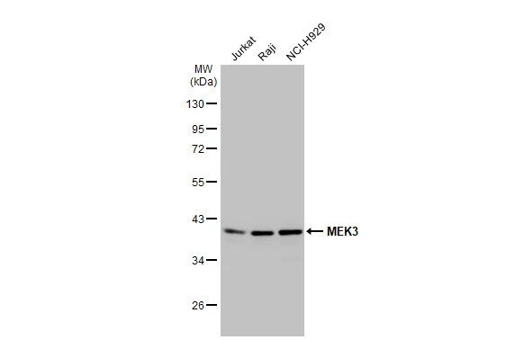 Various whole cell extracts (30 μg) were separated by 10% SDS-PAGE, and the membrane was blotted with MEK3 antibody [N1C3] (GTX107529) diluted at 1:1000. The HRP-conjugated anti-rabbit IgG antibody (GTX213110-01) was used to detect the primary antibody.