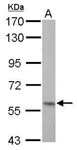 Pyruvate Kinase (liver/RBC) antibody detects PKLR protein by Western blot analysis. A. 50 ug rat liver lysate/extract 7.5 % SDS-PAGE Pyruvate Kinase (liver/RBC) antibody (GTX107546) dilution: 1:500