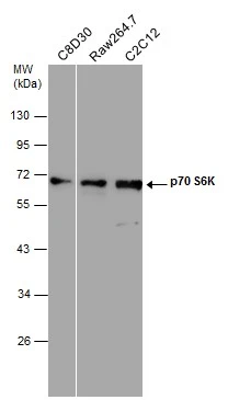 Anti-p70 S6K antibody (GTX107562) | GeneTex
