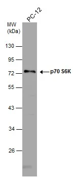 新到着 Anti-p70 GeneTex | (GTX107562) antibody S6K その他