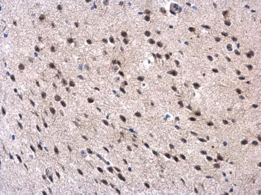 MPP3 antibody [N1C1] detects MPP3 protein at cytoplasm and nucleus in mouse brain by immunohistochemical analysis. Sample: Paraffin-embedded mouse brain. MPP3 antibody [N1C1] (GTX107608) diluted at 1:500. 
 Antigen Retrieval: Citrate buffer, pH 6.0, 15 min