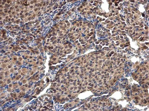 Selenophosphate synthetase 1 antibody [N1C1-2] detects Selenophosphate synthetase 1 protein at cytoplasm and nucleus on mouse ovary by immunohistochemical analysis. Sample: Paraffin-embedded mouse ovary. Selenophosphate synthetase 1 antibody [N1C1-2] (GTX107611) diluted at 1:500. 
 Antigen Retrieval: Trilogy? (EDTA based, pH 8.0) buffer, 15min