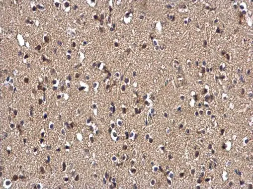 Selenophosphate synthetase 1 antibody [N1C1-2] detects Selenophosphate synthetase 1 protein at cytoplasm and nucleus on mouse brain by immunohistochemical analysis. Sample: Paraffin-embedded mouse brain. Selenophosphate synthetase 1 antibody [N1C1-2] (GTX107611) diluted at 1:500. 
 Antigen Retrieval: Trilogy? (EDTA based, pH 8.0) buffer, 15min