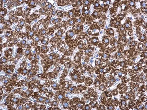 Adenylate kinase 2 antibody [N1C3] detects Adenylate kinase 2 protein at mitochondria in rat liver by immunohistochemical analysis. Sample: Paraffin-embedded rat liver. Adenylate kinase 2 antibody [N1C3] (GTX107613) diluted at 1:500. 
 Antigen Retrieval: Citrate buffer, pH 6.0, 15 min