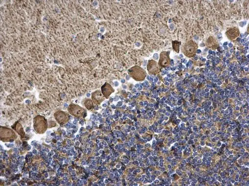 PKC gamma antibody detects PKC gamma protein at cytoplasm on mouse brain by immunohistochemical analysis. Sample: Paraffin-embedded mouse brain. PKC gamma antibody (GTX107639) diluted at 1:500.
Antigen Retrieval: Trilogy? (EDTA based, pH 8.0) buffer, 15min PKC gamma antibody detects PKC gamma protein at cytoplasm on mouse brain by immunohistochemical analysis. Sample: Paraffin-embedded mouse brain. PKC gamma antibody (GTX107639) diluted at 1:500.
Antigen Retrieval: Trilogy? (EDTA based, pH 8.0) buffer, 15min