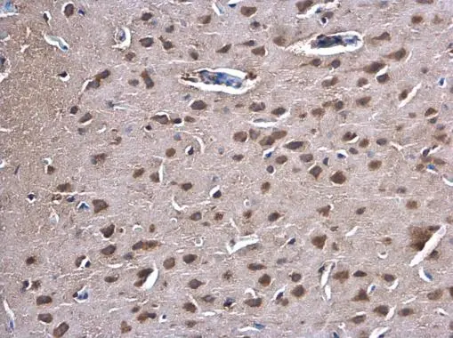 PKC gamma antibody detects PKC gamma protein at cytoplasm in rat brain by immunohistochemical analysis. Sample: Paraffin-embedded rat brain. PKC gamma antibody (GTX107639) diluted at 1:500.
Antigen Retrieval: Trilogy? (EDTA based, pH 8.0) buffer, 15min PKC gamma antibody detects PKC gamma protein at cytoplasm in rat brain by immunohistochemical analysis. Sample: Paraffin-embedded rat brain. PKC gamma antibody (GTX107639) diluted at 1:500.
Antigen Retrieval: Trilogy? (EDTA based, pH 8.0) buffer, 15min