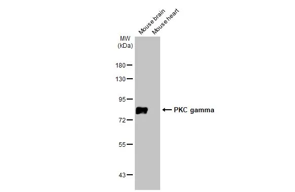 Various tissue extracts (50 μg) were separated by 7.5% SDS-PAGE, and the membrane was blotted with PKC gamma antibody (GTX107639) diluted at 1:3000. The HRP-conjugated anti-rabbit IgG antibody (GTX213110-01) was used to detect the primary antibody. Various tissue extracts (50 μg) were separated by 7.5% SDS-PAGE, and the membrane was blotted with PKC gamma antibody (GTX107639) diluted at 1:3000. The HRP-conjugated anti-rabbit IgG antibody (GTX213110-01) was used to detect the primary antibody.