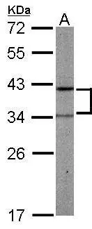 Sample (50 ug of whole cell lysate) A: mouse liver 12% SDS PAGE GTX107648 diluted at 1:1000