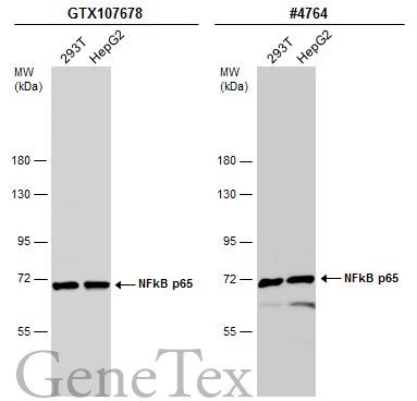 NFkB p65 antibody immunoprecipitates NFkB p65 protein in IP experiments.