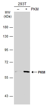 Non-transfected (–) and transfected (+) 293T whole cell extracts (30 μg) were separated by 7.5% SDS-PAGE, and the membrane was blotted with PKM antibody (GTX107681) diluted at 1:500. The HRP-conjugated anti-rabbit IgG antibody (GTX213110-01) was used to detect the primary antibody.