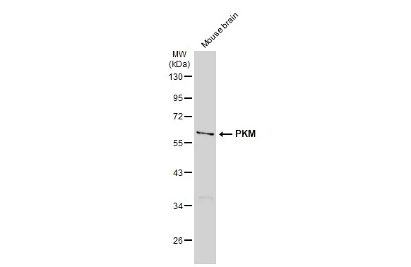 Mouse tissue extract (50 μg) was separated by 10% SDS-PAGE, and the membrane was blotted with PKM antibody (GTX107681) diluted at 1:1000. The HRP-conjugated anti-rabbit IgG antibody (GTX213110-01) was used to detect the primary antibody, and the signal was developed with Trident ECL plus-Enhanced.