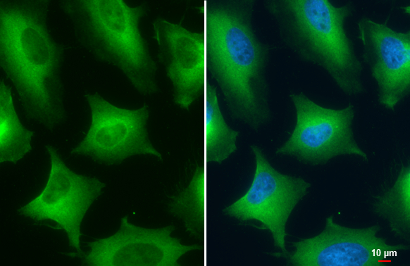 PKM antibody detects PKM protein at cytoplasm by immunofluorescent analysis. Sample: HeLa cells were fixed in 4% paraformaldehyde at RT for 15 min. Green: PKM stained by PKM antibody (GTX107681) diluted at 1:500.