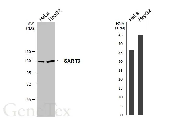 Various whole cell extracts (30 μg) were separated by 7.5% SDS-PAGE, and the membrane was blotted with SART3 antibody [C3], C-term (GTX107684) diluted at 1:1000. The HRP-conjugated anti-rabbit IgG antibody (GTX213110-01) was used to detect the primary antibody. Corresponding RNA expression data for the same cell lines are based on Human Protein Atlas program.