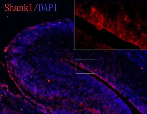 SHANK1 antibody [C3] detects SHANK1 protein on embryonic mouse brain by immunohistochemical analysis. Sample: Frozen section of embryonic mouse brain (mE18.5). Red: SHANK1 antibody [C3] (GTX107701) diluted at 1:250. Blue: DAPI