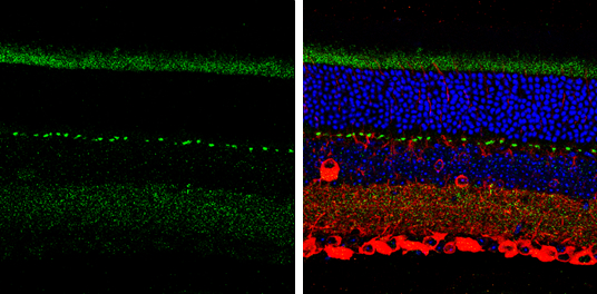 SHANK1 antibody [C3], C-term detects SHANK1 protein by immunohistochemical analysis. Samples: Paraffin-Embedded mouse retina. Green: SHANK1 protein stained by SHANK1 antibody [C3], C-term (GTX107701) diluted at 1:250. Red: beta Tubulin 3/ Tuj1, stained by beta Tubulin 3/ Tuj1 antibody [GT1338] (GTX631831) diluted at 1:500. Blue: Fluoroshield with DAPI (GTX30920). 
 Antigen Retrieval: Citrate buffer, pH 6.0, 15 min