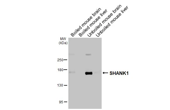 Boiled and unboiled various tissue extracts (50 μg) were separated by 5% SDS-PAGE, and the membrane was blotted with SHANK1 antibody [C3], C-term (GTX107701) diluted at 1:1000. The HRP-conjugated anti-rabbit IgG antibody (GTX213110-01) was used to detect the primary antibody.