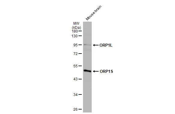 Mouse tissue extract (50 μg) was separated by 10% SDS-PAGE, and the membrane was blotted with ORP1 antibody [C3], C-term (GTX107722) diluted at 1:1000. The HRP-conjugated anti-rabbit IgG antibody (GTX213110-01) was used to detect the primary antibody, and the signal was developed with Trident ECL plus-Enhanced.