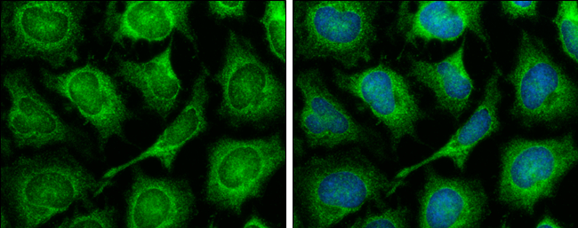 TOMM7 antibody [N1C3] detects TOMM7 protein at mitochondria by immunofluorescent analysis. Sample: HeLa cells were fixed in ice-cold MeOH for 5 min. Green: TOMM7 stained by TOMM7 antibody [N1C3] (GTX107731) diluted at 1:500. Blue: Hoechst 33342 staining.