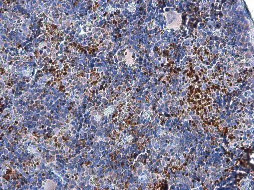 FOXP3 antibody [C3], C-term detects FOXP3 protein at cytoplasm and nucleus in mouse spleen by immunohistochemical analysis. Sample: Paraffin-embedded mouse spleen. FOXP3 antibody [C3], C-term (GTX107737) diluted at 1:500. 
 Antigen Retrieval: Citrate buffer, pH 6.0, 15 min