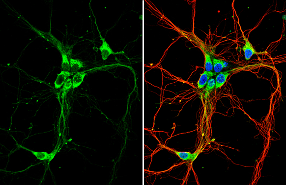 GPR30 antibody detects GPR30 protein by immunofluorescent analysis. Sample: DIV9 rat E18 primary hippocampal neuron cells were fixed in 4% paraformaldehyde at RT for 15 min. Green: GPR30 stained by GPR30 antibody (GTX107748) diluted at 1:500. Red: beta Tubulin 3/ Tuj1, stained by beta Tubulin 3/ Tuj1 antibody [GT11710] (GTX631836) diluted at 1:500. Blue: Fluoroshield with DAPI (GTX30920).