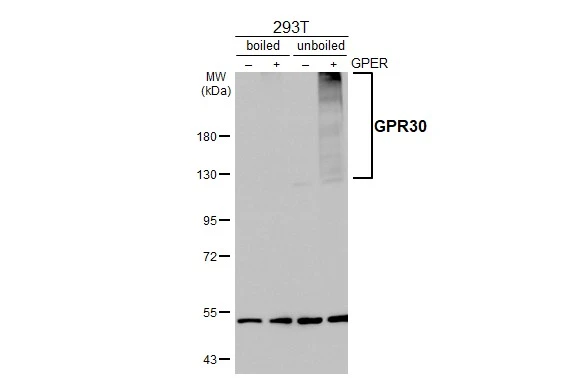 Non-transfected (–) and transfected (+) bolied and unboiled 293T whole cell extracts (30 μg) were separated by 7.5% SDS-PAGE, and the membrane was blotted with GPR30 antibody [C2C3], C-term (GTX107748) diluted at 1:5000. The HRP-conjugated anti-rabbit IgG antibody (GTX213110-01) was used to detect the primary antibody, and the signal was developed with Trident ECL plus-Enhanced.