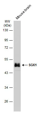 Mouse tissue extract (50 μg) was separated by 10% SDS-PAGE, and the membrane was blotted with SGK1 antibody (GTX107750) diluted at 1:500. The HRP-conjugated anti-rabbit IgG antibody (GTX213110-01) was used to detect the primary antibody, and the signal was developed with Trident ECL plus-Enhanced.