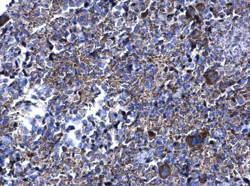 PFKFB4 antibody detects PFKFB4 protein at cytoplasm on mouse spleen by immunohistochemical analysis. Sample: Paraffin-embedded mouse spleen. PFKFB4 antibody (GTX107755) diluted at 1:500.
Antigen Retrieval: Trilogy? (EDTA based, pH 8.0) buffer, 15min PFKFB4 antibody detects PFKFB4 protein at cytoplasm on mouse spleen by immunohistochemical analysis. Sample: Paraffin-embedded mouse spleen. PFKFB4 antibody (GTX107755) diluted at 1:500.
Antigen Retrieval: Trilogy? (EDTA based, pH 8.0) buffer, 15min