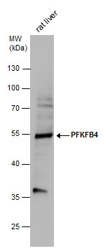 PFKFB4 antibody detects PFKFB4 protein by Western blot analysis. Mouse tissue extracts (50 μg) was separated by 10% SDS-PAGE, and the membrane was blotted with PFKFB4 antibody (GTX107755) diluted at 1:2000.