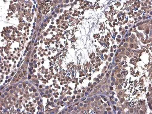 PFKFB4 antibody detects PFKFB4 protein at cytoplasm in mouse testis by immunohistochemical analysis. Sample: Paraffin-embedded mouse testis. PFKFB4 antibody (GTX107755) diluted at 1:500.
Antigen Retrieval: Citrate buffer, pH 6.0, 15 min PFKFB4 antibody detects PFKFB4 protein at cytoplasm in mouse testis by immunohistochemical analysis. Sample: Paraffin-embedded mouse testis. PFKFB4 antibody (GTX107755) diluted at 1:500.
Antigen Retrieval: Citrate buffer, pH 6.0, 15 min
